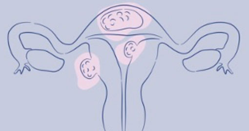 Line drawing of a uterus