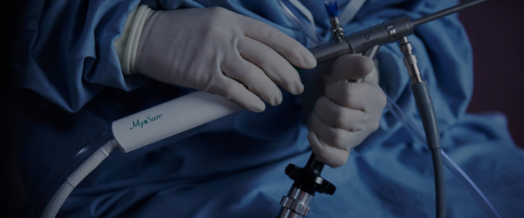 surgeon holding myosure device