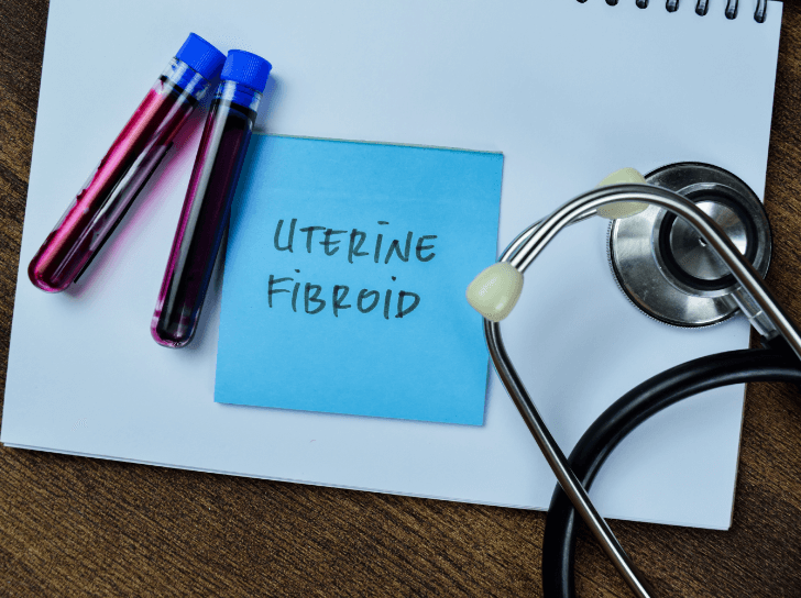 Vials of blood on a table with stethoscope and a sticky note saying, "Uterine Fibroid"